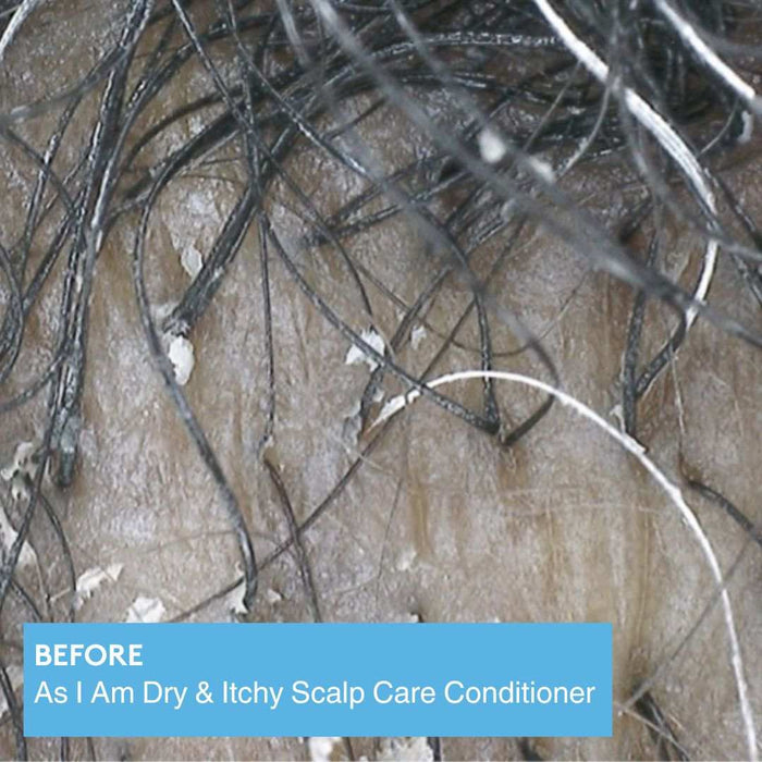 As I Am Dry & Itchy Scalp Care Conditioner 12oz for soothing dry and itchy scalp, relieving dandruff and irritation, moisturizing and detangling hair