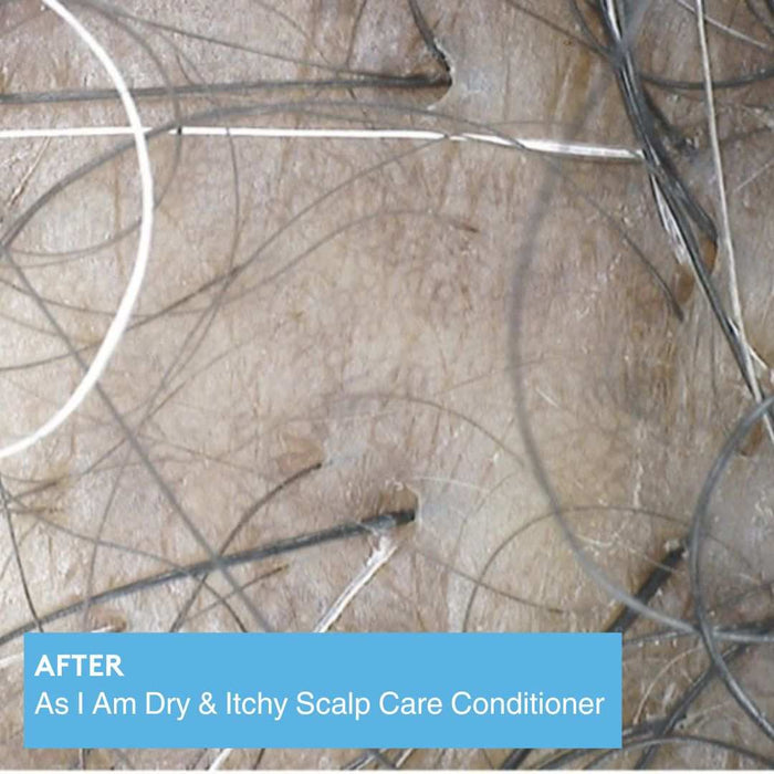 As I Am Dry & Itchy Scalp Care Conditioner 12oz for soothing dry, itchy scalp and dandruff relief