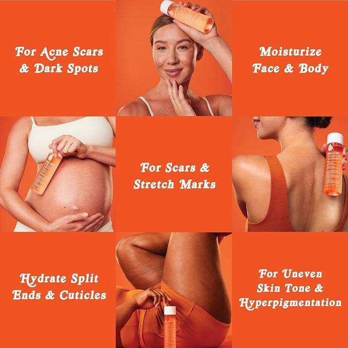 Bio - Oil Skincare Oil زيت العناية بالبشرة من بيو - أويل - Princess Cosmetics Qatar