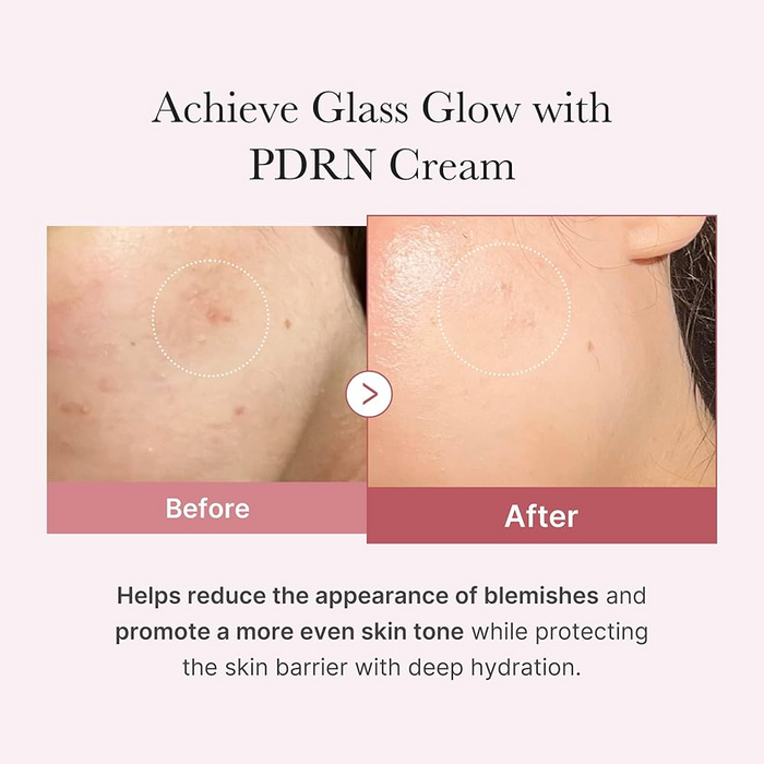 Medicube PDRN Pink Hyaluronic Moisturizing Cream 50 ml