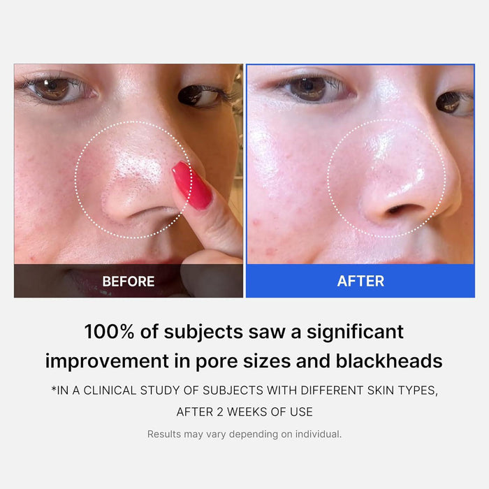 Medicube Zero Pore Pad 70 pads