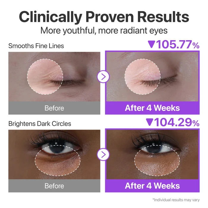 NUMBUZIN No.9 NAD+ Retinol Volumetox Eye Cream كريم العين من نومبوزين