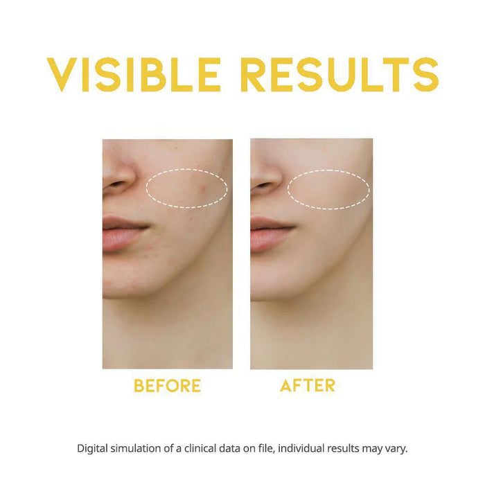OOTD Beauty Dark Spot Vitamin C Serum 50 mL