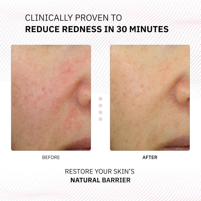 Physiogel Calming Relief Redness Relieving Cream