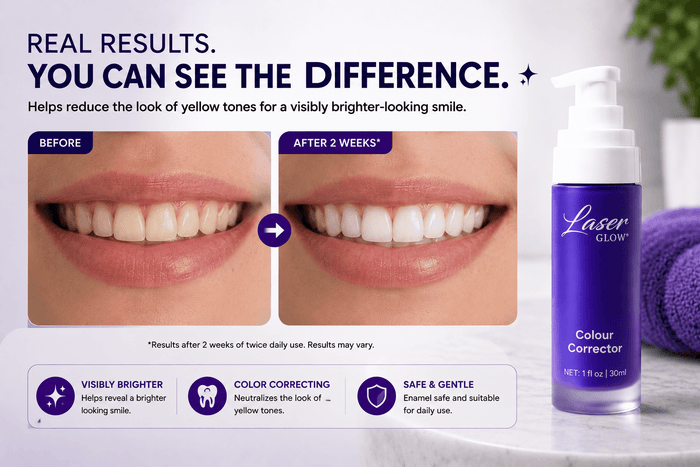 Purple toothpaste before and after smile comparison