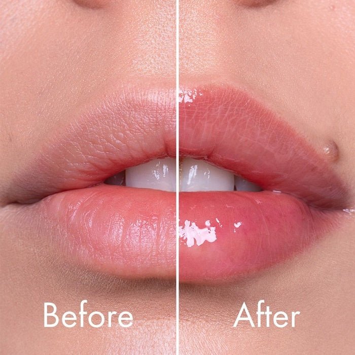REEDLE SHOT LIP PLUMPER BEGINNER - Balsam De Buze Cu Efect De Voluminizare - skinseen.ro