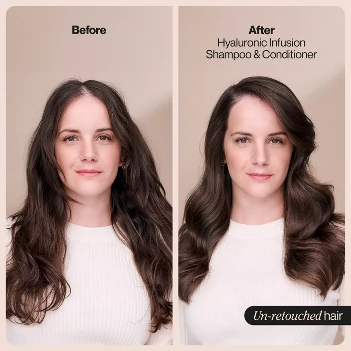 SUAVE Hyaluronic Infusion Moisturizing Shampoo شامبو مرطب غني بحمض الهيالورونيك