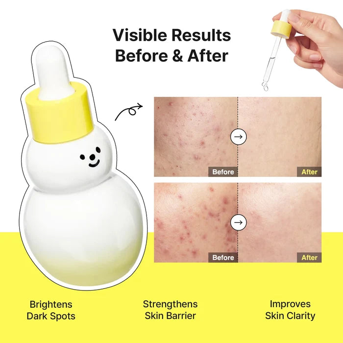 TIAM VITA B3 SOURCE Niacinamide 10% + Arbutin 2% Holiday Special  سيروم النياسيناميد والالفا اربوتين بالاصدار المحدود من تيام