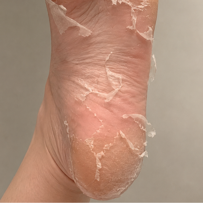 VOESH - Exfoliating Peeling Socks - 1 sæt