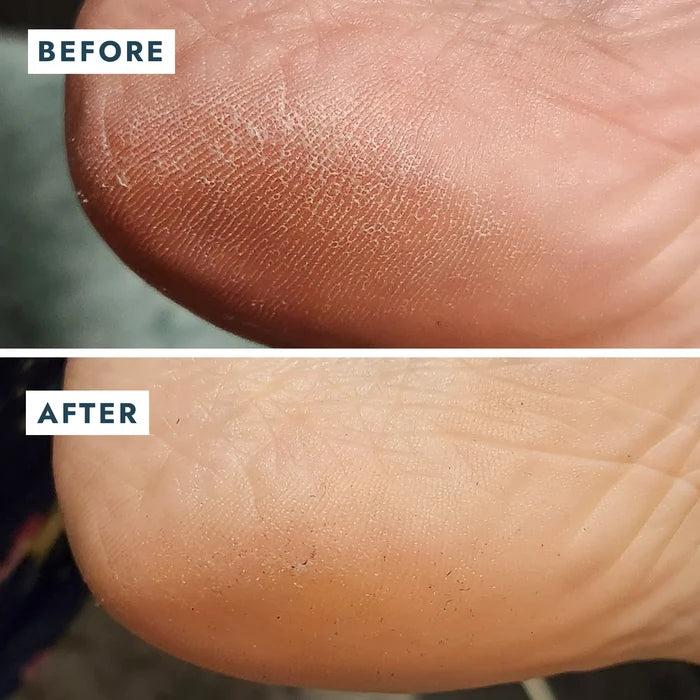 Heel Repair Duo Mint